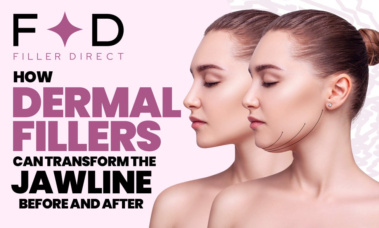 How Dermal Fillers can transform the jawline - Before and after